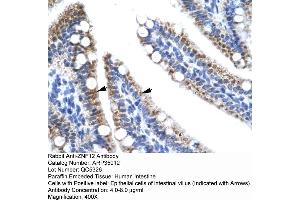 Human Intestine (ZNF12 抗体  (N-Term))