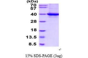RLBP1 Protein (AA 1-317) (His tag)