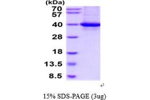 SDS-PAGE (SDS) image for Plasminogen Activator, Urokinase Receptor (PLAUR) (AA 23-305) protein (His tag) (ABIN5854660)