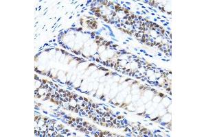 Immunohistochemistry of paraffin-embedded human colon using UHRF1 antibody. (UHRF1 抗体  (AA 1-260))