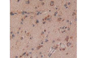 Used in DAB staining on fromalin fixed paraffin- embedded Kidney tissue (IRF8 抗体  (AA 128-426))