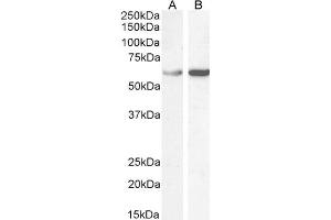 ABIN185185 (1µg/ml) staining of Human Ovary (A) lysate and HEK293 (B) cell lysate (35µg protein in RIPA buffer).