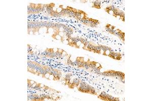 Immunohistochemistry of paraffin embedded rat small intestine using APOA4 (ABIN7073084) at dilution of 1:1200 (300x lens) (APOA4 抗体)