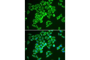Immunofluorescence (IF) image for anti-Kelch-Like ECH-Associated Protein 1 (KEAP1) (AA 325-624) antibody (ABIN3022609)