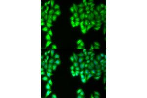 Immunofluorescence analysis of U2OS cells using MALT1 antibody (ABIN5971171).