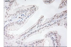 Immunohistochemical staining of paraffin-embedded prostate tissue using anti-TNNI3mouse monoclonal antibody. (TNNI3 抗体  (AA 1-210))