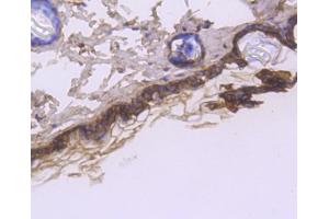 Paraformaldehyde-fixed, paraffin embedded rat spinal cord, Antigen retrieval by boiling in sodium citrate buffer (pH6) for 15min, Block endogenous peroxidase by 3% hydrogen peroxide for 30 minutes, Blocking buffer at 37°C for 20min, Antibody incubation with Cytokeratin 1 (1C2) Monoclonal Antibody  at 1:50 overnight at 4°C, followed by a conjugated secondary and DAB staining. (Cytokeratin 1 抗体)