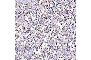 IHC analysis of SUCLG1 using anti-SUCLG1 antibody (ABIN7600906). (SUCLG1 抗体  (AA 25-346))