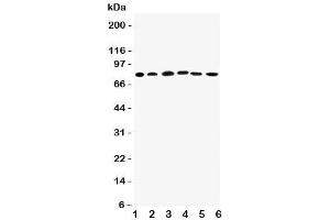 Western blot testing of Proprotein Convertase 1/3 antibody (Proprotein Convertase 1/3 (C-Term) 抗体)
