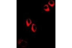 Immunofluorescent analysis of COQ3 staining in A549 cells. (COQ3 抗体)
