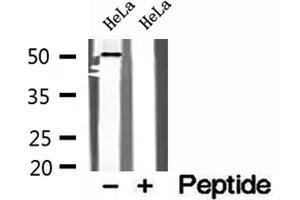 Western blot analysis of extracts of HeLa cells, using SNX17 antibody. (SNX17 抗体  (N-Term))