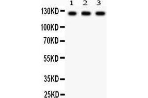 Anti-PLD1 Picoband antibody, Western blotting All lanes: Anti PLD1  at 0. (PLD1 抗体  (AA 1-330))