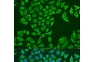 Immunofluorescence analysis of U2OS cells using ALDH1B1 Polyclonal Antibody at dilution of 1:100. (ALDH1B1 抗体)