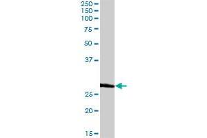 BCAP31 MaxPab rabbit polyclonal antibody. (BCAP31 抗体  (AA 1-246))