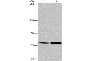 Western blot analysis of Hela and K562 cell, using GAB2 Polyclonal Antibody at dilution of 1:300 (GAB2 抗体)