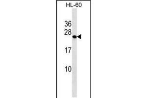 Western blot analysis in HL-60 cell line lysates (35ug/lane). (PCTP 抗体  (AA 59-87))