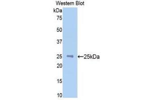 Western Blotting (WB) image for anti-N-Acetylgalactosaminidase, alpha (NAGA) (AA 218-415) antibody (ABIN1859956) (NAGA 抗体  (AA 218-415))