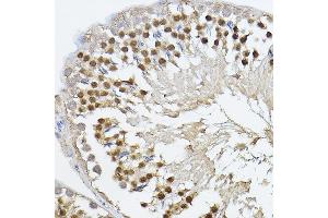 Immunohistochemistry of paraffin-embedded rat testis using PRDM14 Rabbit pAb (ABIN6128496, ABIN6146133, ABIN6146136 and ABIN6221189) at dilution of 1:100 (40x lens). (PRDM14 抗体  (AA 1-571))