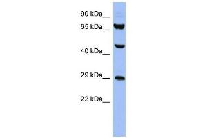SNRPB antibody used at 1 ug/ml to detect target protein.