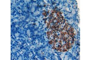 IHC-P analysis of Kidney tissue, with DAB staining. (iPLA2 抗体  (AA 481-702))