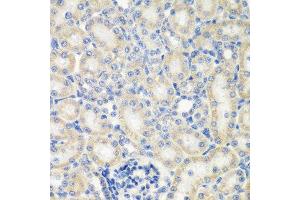 Immunohistochemistry of paraffin-embedded rat kidney using NAA50 antibody. (NAA50 抗体  (AA 1-169))