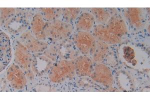 Detection of SLC9A3R2 in Human Kidney Tissue using Polyclonal Antibody to Sodium Hydrogen Exchange Regulatory Cofactor 2 (SLC9A3R2)