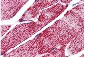 Human Skeletal Muscle: Formalin-Fixed, Paraffin-Embedded (FFPE) (HSPA9 抗体  (C-Term))