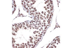 Immunohistochemistry of paraffin-embedded rat testis using HMGB2 Rabbit mAb (ABIN7267649) at dilution of 1:100 (40x lens). (HMGB2 抗体)