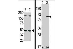 (LEFT) The SPHK1 polyclonal antibody  is used in Western blot (Lane 2) to detect c-myc-tagged SPHK1 in transfected 293 cell lysate (ac-myc antibody is used as control in Lane 1). (SPHK1 抗体  (N-Term))