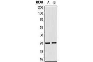 Western blot analysis of NKX2-6 expression in MCF7 (A), COLO205 (B) whole cell lysates. (NKX2-6 抗体  (Center))