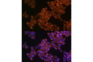 Immunofluorescence analysis of HeLa cells using SQLE Rabbit pAb (ABIN1513563, ABIN5664074, ABIN5664075, ABIN5664076 and ABIN6219540) at dilution of 1:100 (40x lens). (SQLE 抗体  (AA 143-400))