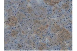 Immunohistochemistry (IHC) image for anti-Cytochrome P450, Family 17, Subfamily A, Polypeptide 1 (CYP17A1) (AA 201-507) antibody (ABIN7444547)