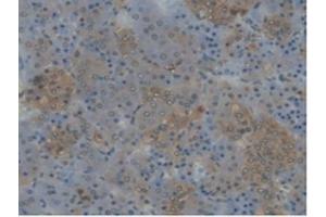 Detection of CYP17A1 in Rat Adrenal gland Tissue using Polyclonal Antibody to Cytochrome P450 17A1 (CYP17A1) (CYP17A1 抗体  (AA 201-507))