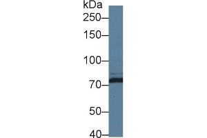 Western Blotting (WB) image for anti-Dicer 1, Ribonuclease Type III (DICER1) (AA 6-290) antibody (ABIN7436789)