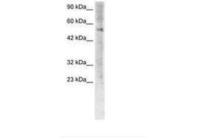 Image no. 3 for anti-Zinc Finger Protein 500 (ZNF500) (AA 348-397) antibody (ABIN6735775) (ZNF500 抗体  (AA 348-397))