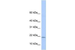 POLR1D antibody used at 1 ug/ml to detect target protein. (POLR1D 抗体)