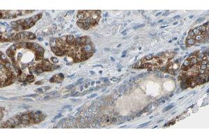 ABIN6279443 at 1/100 staining Human prostate tissue by IHC-P. (Gephyrin 抗体  (Internal Region))
