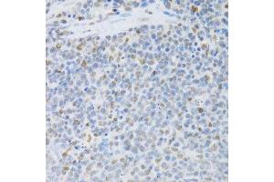 Immunohistochemistry of paraffin-embedded rat spleen using SFN Antibody. (14-3-3 sigma/SFN 抗体  (AA 1-248))
