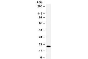 Western blot testing of human K562 cell lysate with APRT antibody at 0. (APRT 抗体  (AA 5-49))