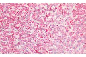 Immunohistochemistry (IHC) image for anti-Growth Arrest-Specific 6 (GAS6) (AA 483-646) antibody (ABIN7431299)