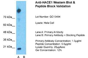 Host: Rabbit  Target Name: HACE1  Sample Tissue: Hela Whole cell  Lane A:  Primary Antibody Lane B: Primary Antibody + Blocking Peptide Primary Antibody Concentration: 1 µg/mL Peptide Concentration: 5 µg/mL Lysate Quantity: 41 µg/lane/LaneGel Concentration:. (HACE1 抗体  (Middle Region))