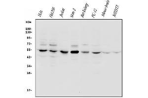 Western blot analysis of VPS4B/MIG1 using anti-VPS4B/MIG1 antibody (ABIN7599560).