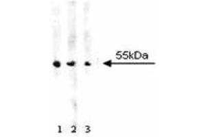 Western blot analysis of ALDH on A431 cell lysate. (Aldehyde Dehydrogenase 抗体  (AA 7-128))