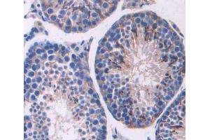 Immunohistochemistry (IHC) image for anti-ATP-Binding Cassette, Sub-Family C (CFTR/MRP), Member 11 (ABCC11) (AA 1127-1366) antibody (ABIN5013192)