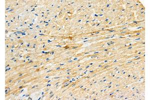 ABIN6264749 and ABIN6277838 at 1/100 staining Rat heart tissue by IHC-P. (RHOQ 抗体  (Internal Region))