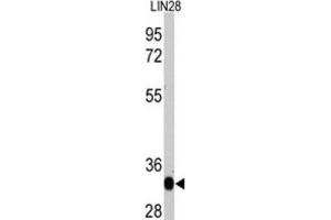 Western Blotting (WB) image for anti-Lin-28 Homolog A (C. Elegans) (LIN28A) antibody (ABIN2995304) (LIN28A 抗体)