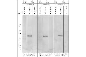 Effect of denaturing temperature on Western blot on brain lysates using Rabbit antibody to ChAT (70-120): . (Choline Acetyltransferase 抗体)