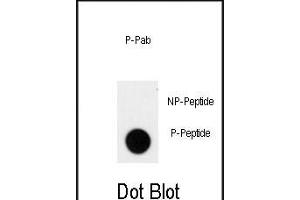 Dot blot analysis of anti-Phospho-ACK1-p Phospho-specific Pab (ABIN650839 and ABIN2839804) on nitrocellulose membrane. (TNK2 抗体  (pTyr826))