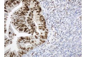 Image no. 7 for anti-Proliferating Cell Nuclear Antigen (PCNA) antibody (ABIN1500061)