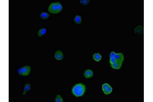 Immunofluorescent analysis of MCF-7 cells using ABIN7167054 at dilution of 1:100 and Alexa Fluor 488-congugated AffiniPure Goat Anti-Rabbit IgG(H+L) (IER3 抗体  (AA 1-82))